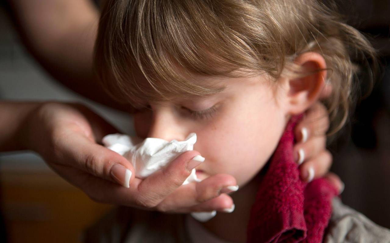 Ein Kind mit Nasenbluten hat Handtuch im Nacken