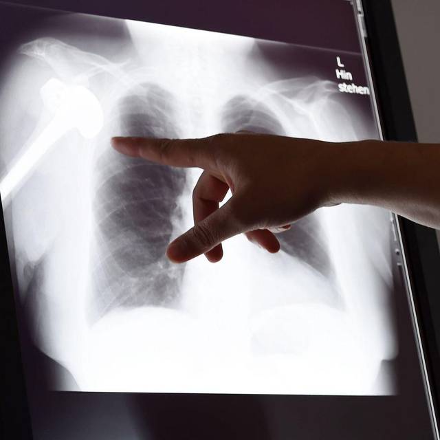 Röntgenbild in Schlichtungsstelle für Arzthaftpflichtfragen