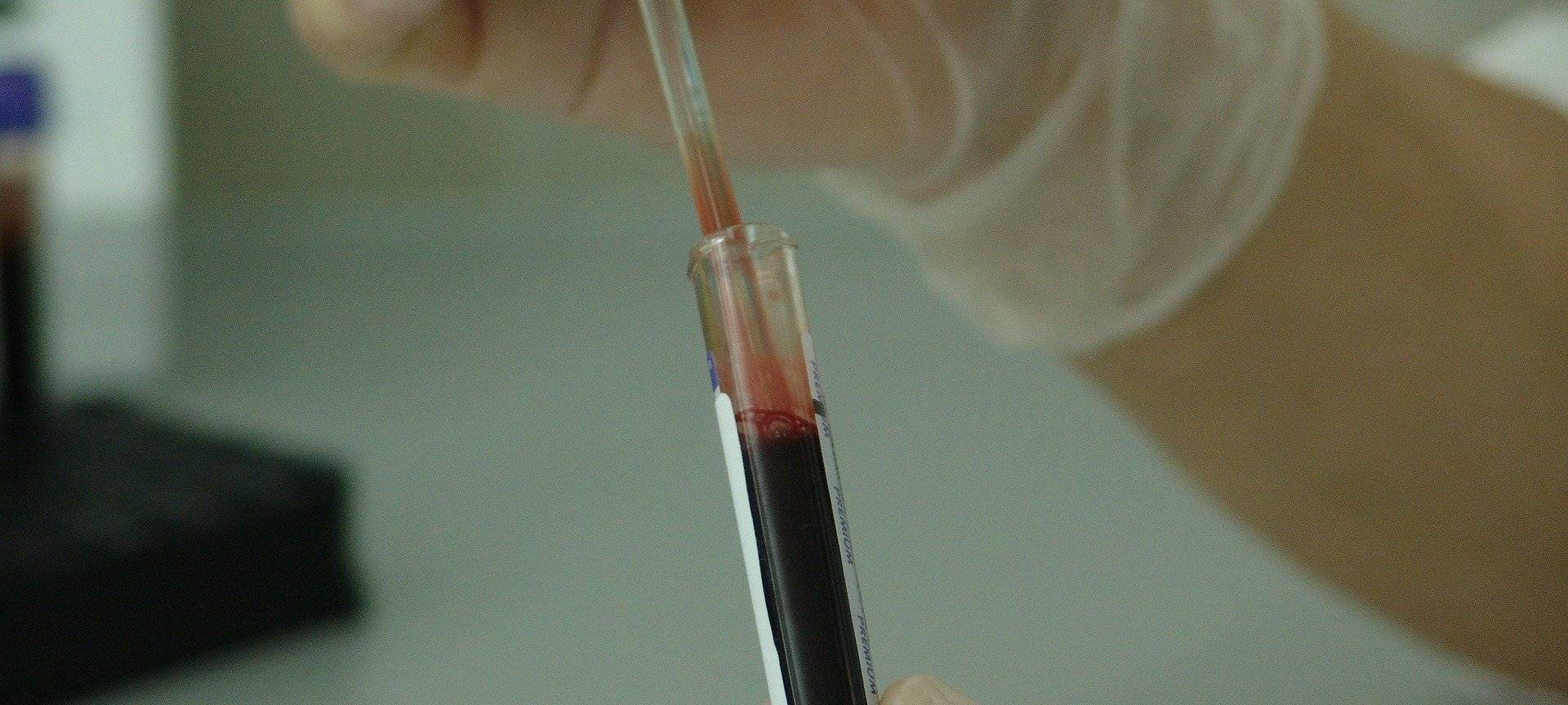 DNA-Test: 945 Männer haben mitgemacht