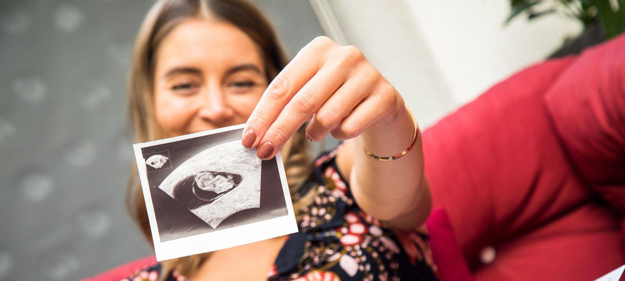 Eine schwangere Frau zeigt ein Ultraschallbild
