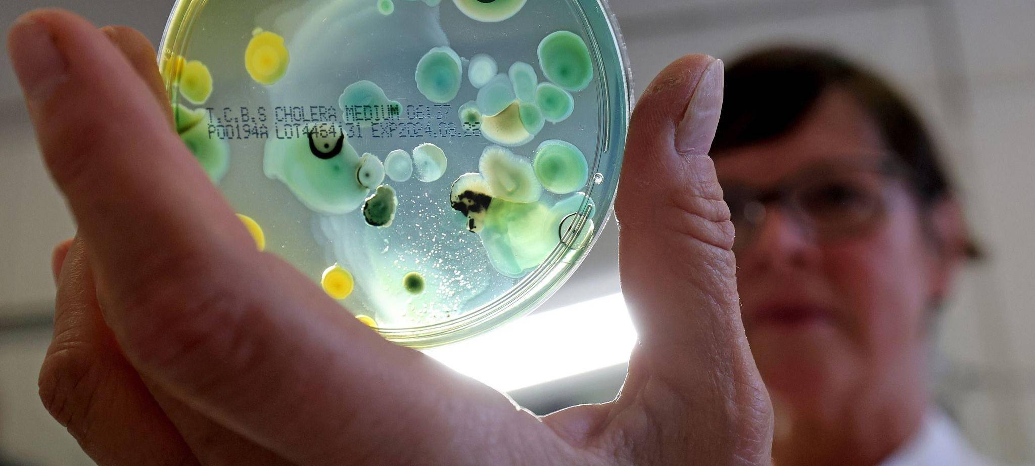 Vibrionen-Nachweis im Landesamt für Gesundheit und Soziales